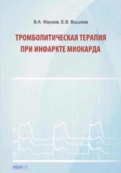 Валентин Марков, Евгений Вышлов - Тромболитическая терапия при инфаркт