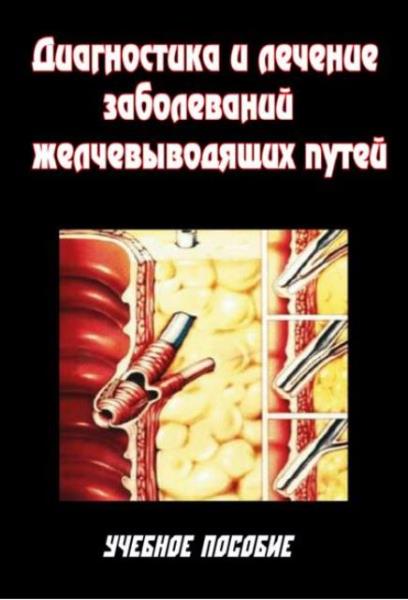 Диагностика и лечение заболеваний желчевыводящих путей. Учебное пособи