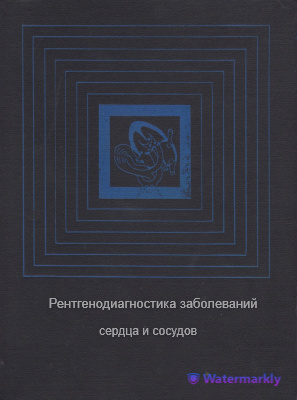 Рентгенодиагностика заболеваний сердца и сосудов